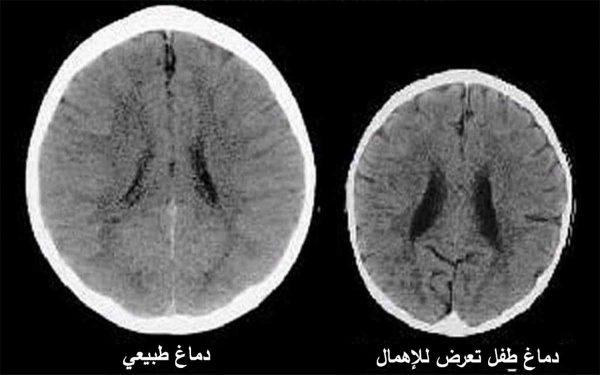 العلماء يكتشفون بالصور تأثير تربية الأم على دماغ أولادها