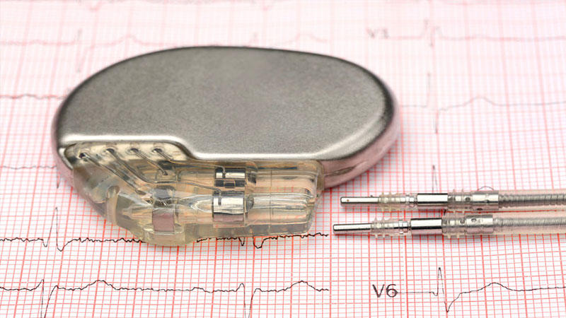  اكتشاف خلل تقني في الناظمات القلبية المستوردة