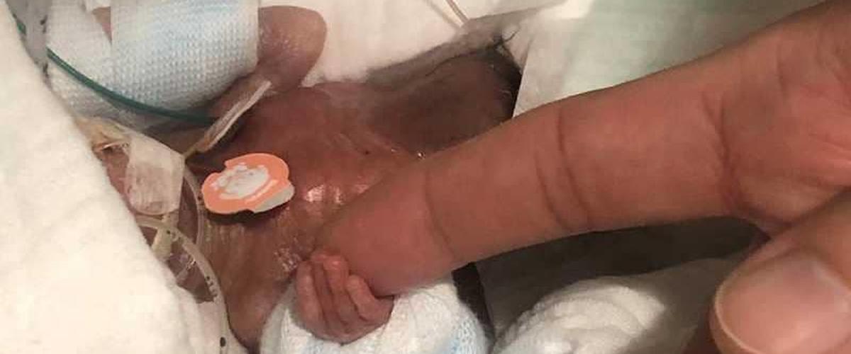 اليابان: أصغر رضيع في العالم بوزن 268 غراما !