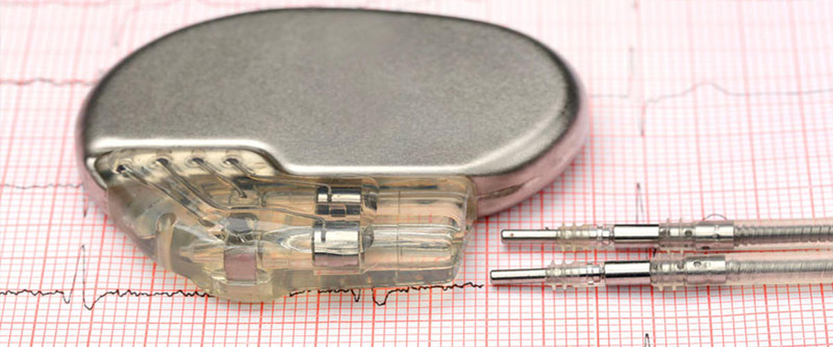  اكتشاف خلل تقني في الناظمات القلبية المستوردة